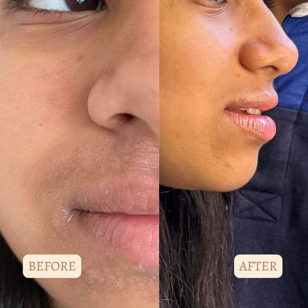 Vandana R. — customer photo